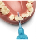 Межзубные ершики 