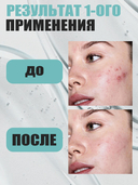 Гель для умывания 