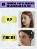 Гель точечного нанесения для лица 