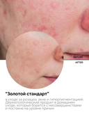 Флюид для лица 